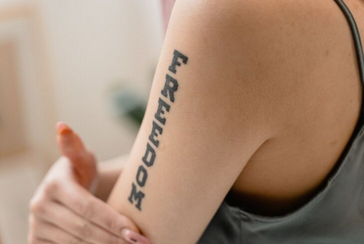 Remoção de tatuagem a laser em SP: perguntas essenciais e comparação de tecnologias