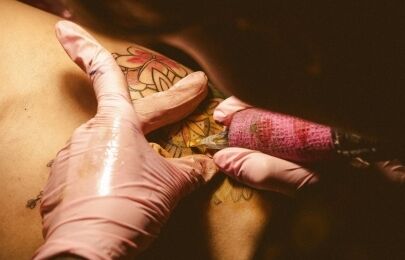 Preço da remoção de tatuagem a laser: guia passo a passo