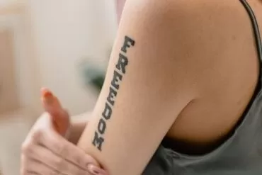 Remoção de tatuagem a laser em SP: perguntas essenciais e comparação de tecnologias