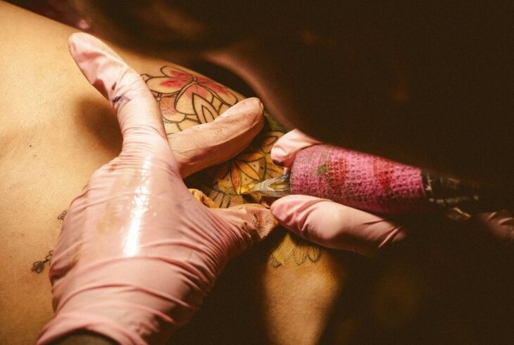 Preço da remoção de tatuagem a laser: guia passo a passo